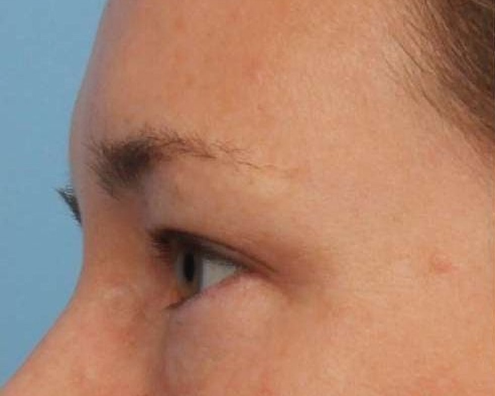 Side profile of a person's face.