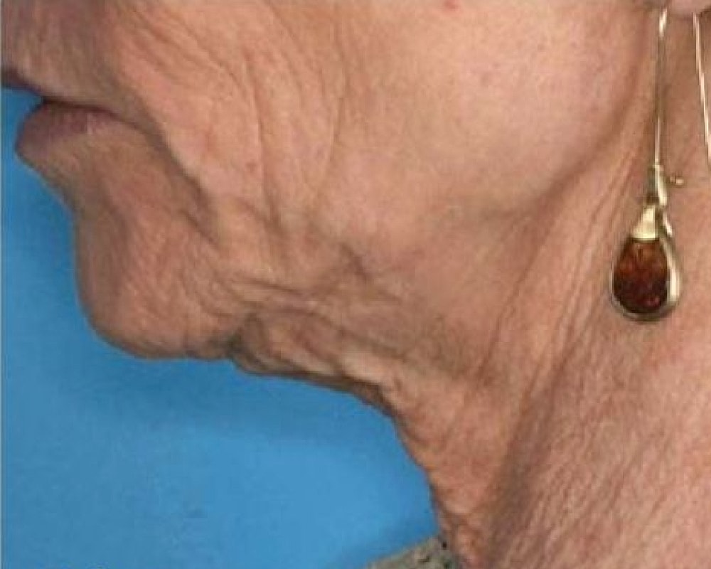 Close-up of an elderly woman's neck and earring.