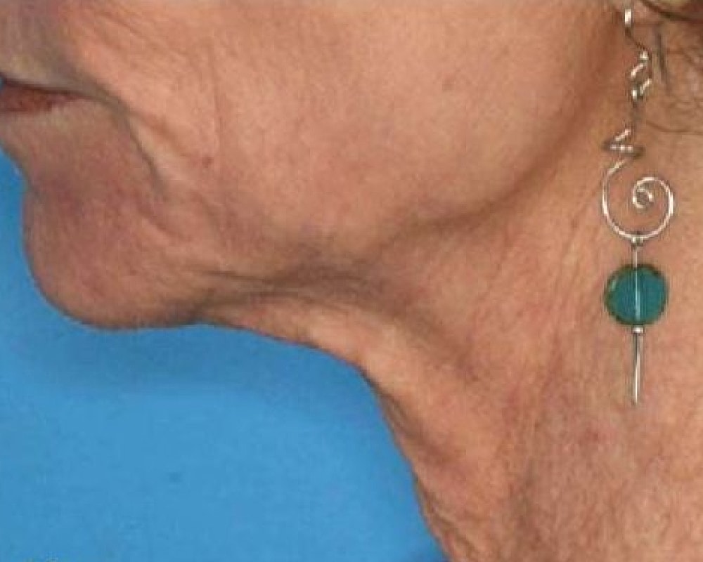 Profile of a person wearing a decorative earring.