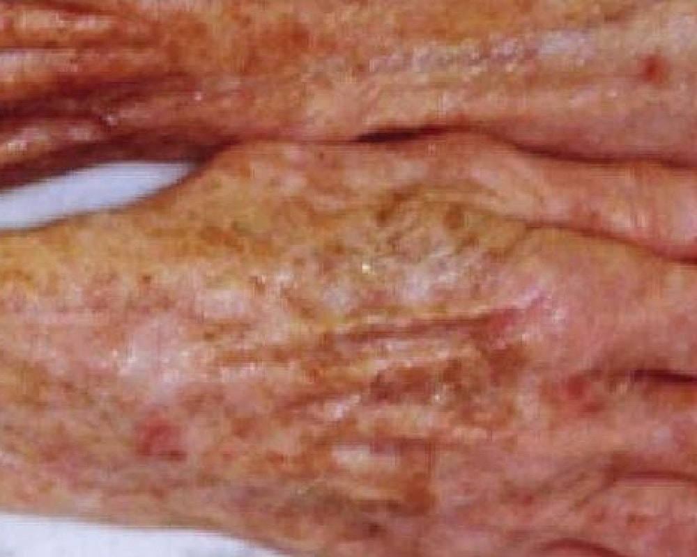 Aging hands with visible skin changes and texture.